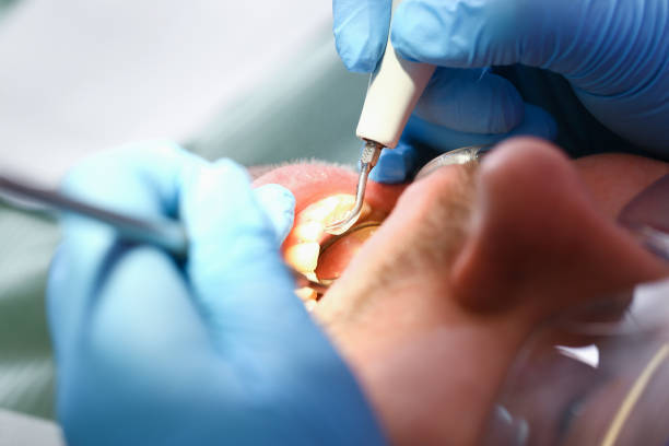 Best Emergency Dental Surgery in Bedford, VA