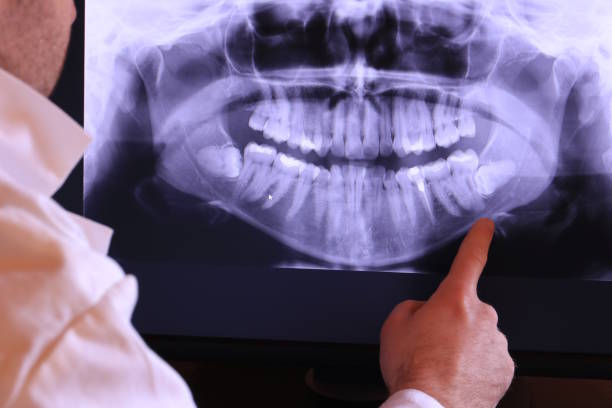 Best Emergency Tooth Extraction in Bedford, VA