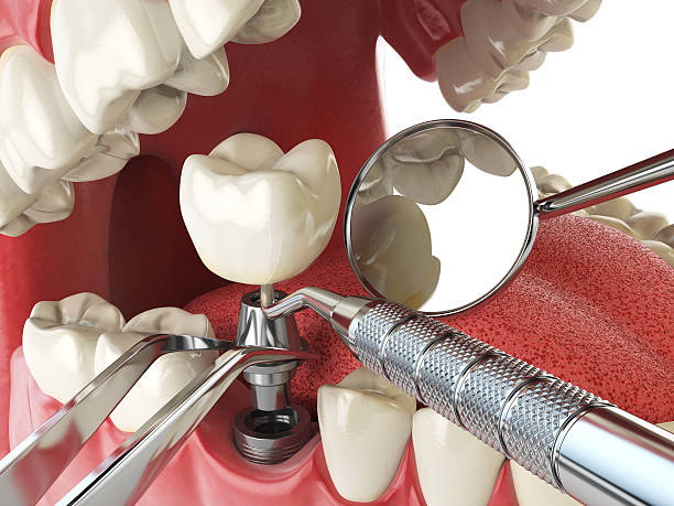 Best Walk-In Emergency Dentist in Bedford, VA
